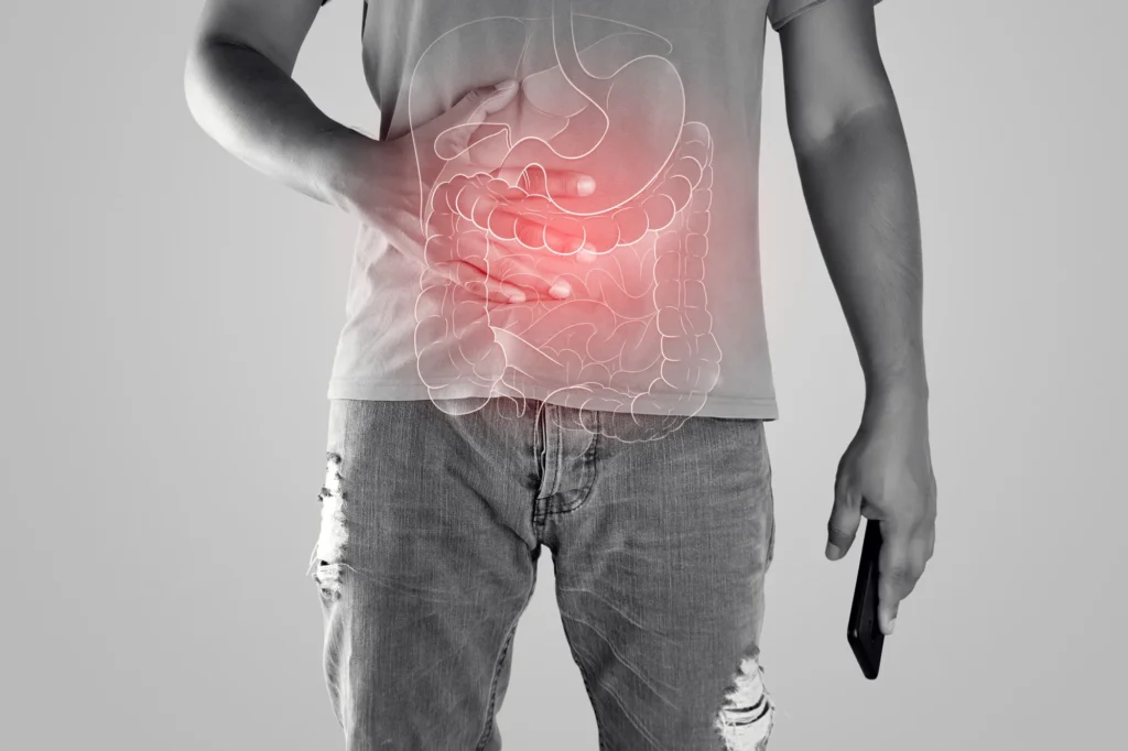 Crohn's Disease