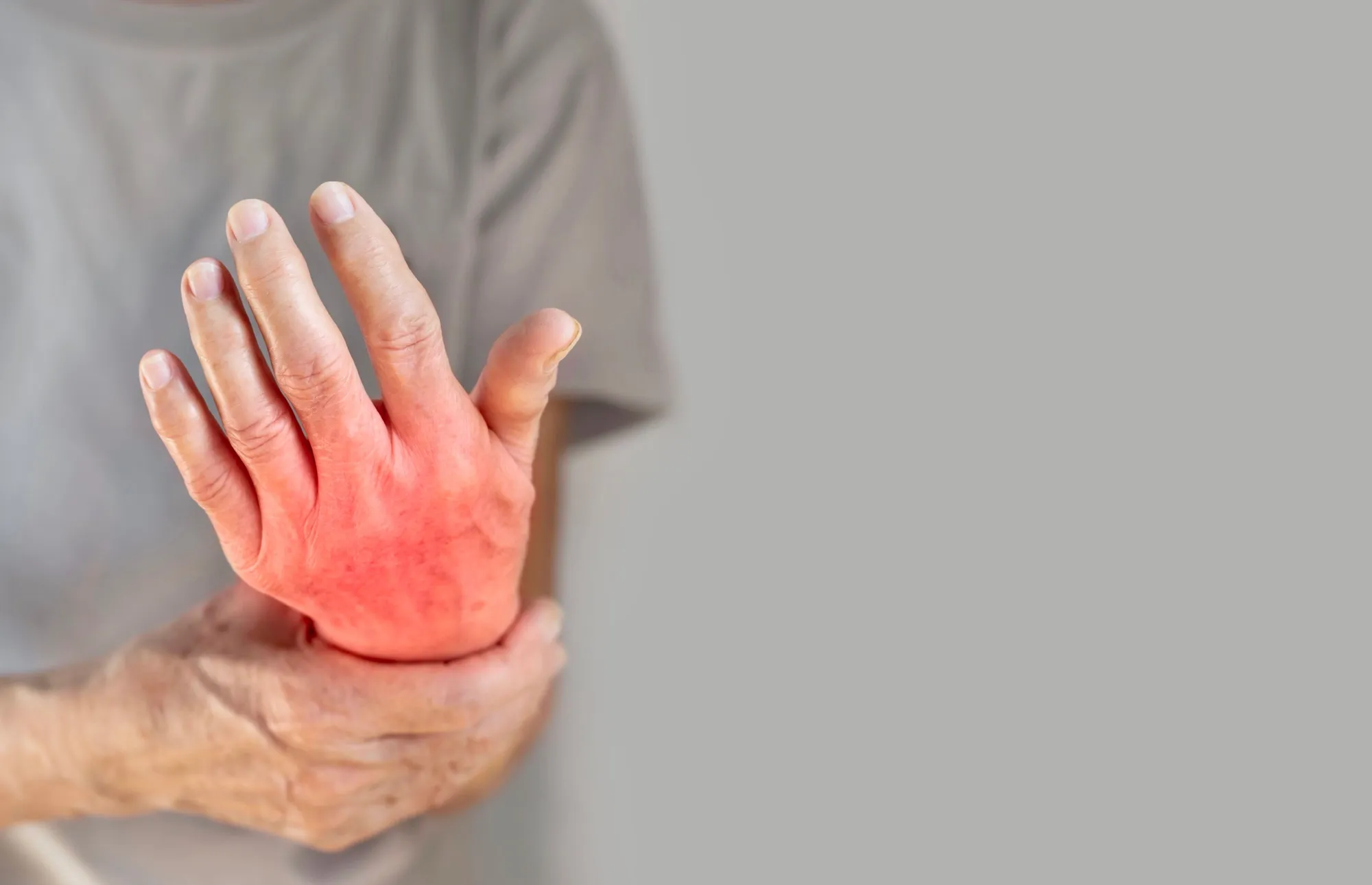 Rheumatoid Arthritis