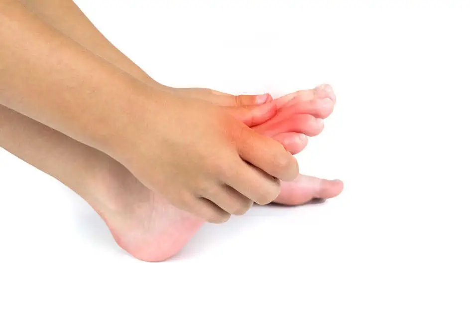 Gout Symptoms by Omega Health Clinics in Modesto, CA 95355